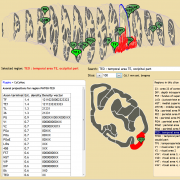 Scalable Brain Atlas